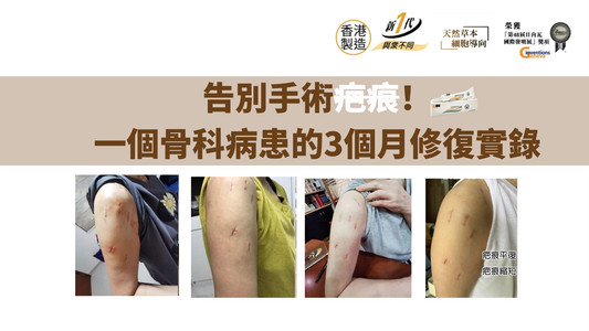 告別手術疤痕!一個骨科病患的3個月修復實錄