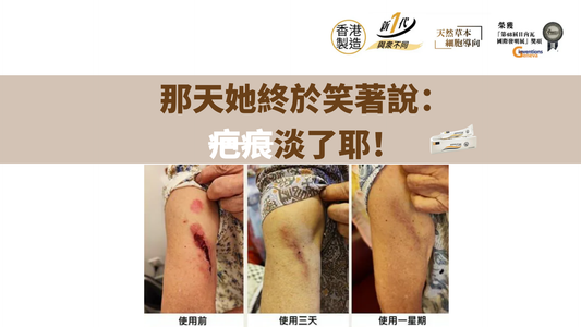 那天她終於笑著說：疤痕淡了耶！