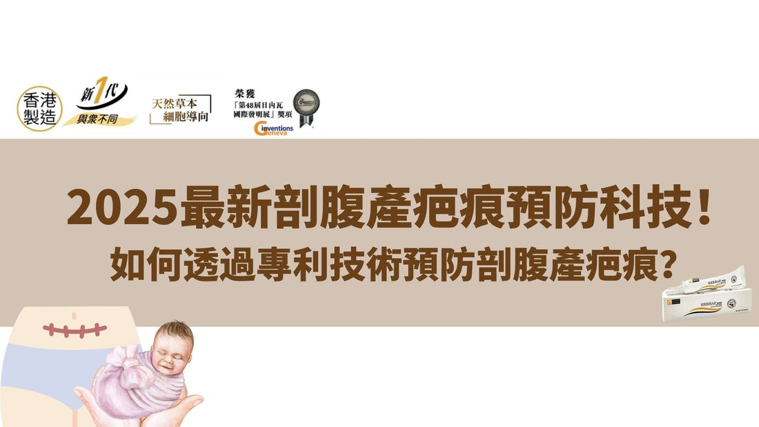 2025最新剖腹產疤痕預防科技！如何透過專利技術預防剖腹產疤痕？