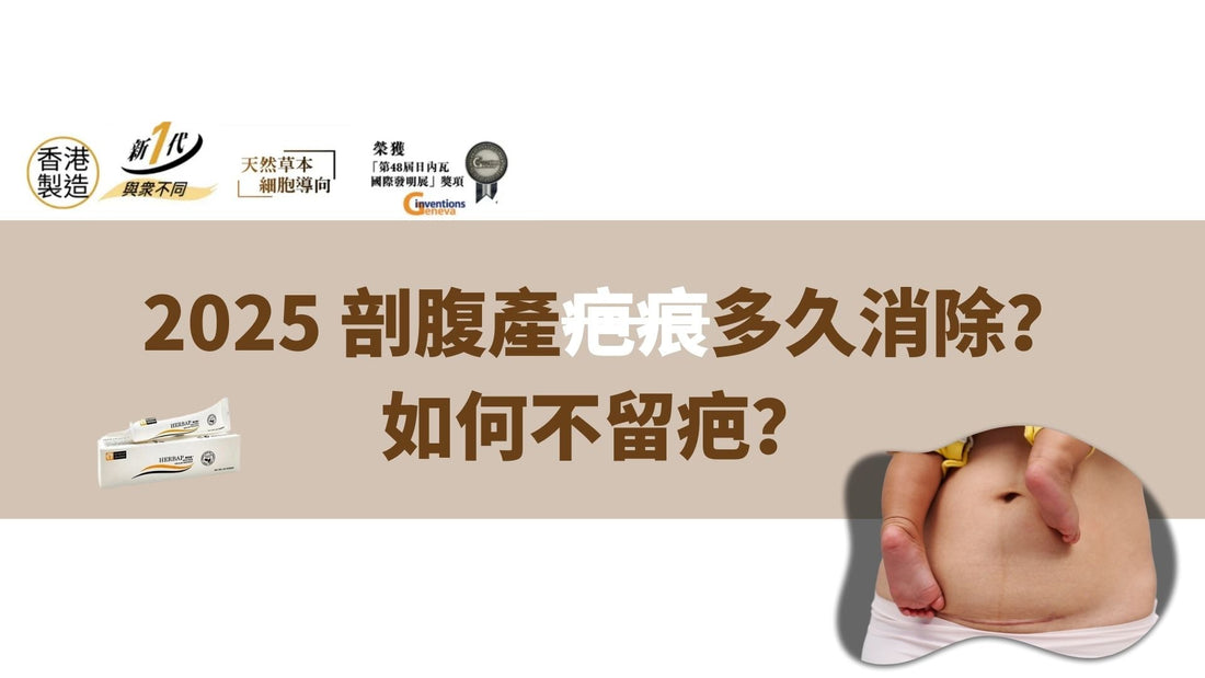 2025 剖腹產疤痕多久消除？如何不留疤？全面解答產後媽媽最關心的疤痕護理問題！